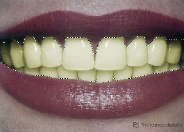 memutihkan-gigi1